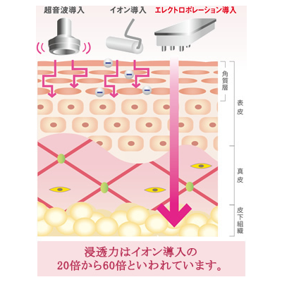 エレクトロポレーション導入器「エポスキン」│株式会社グランディール エレクトロポレーション導入器「エポスキン」│株式会社グランディール